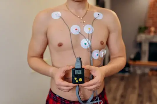 Holter Monitoring